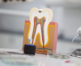 Model of inside of the tooth
