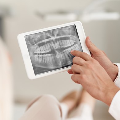 Dental x-rays on tablet computer